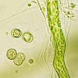 Pogosta predstavnika alg v vzorcih flore okoli svetil (Gloeocapsa sp. levo in Trentepohlia aurea desno). (Foto: Janez Mulec)